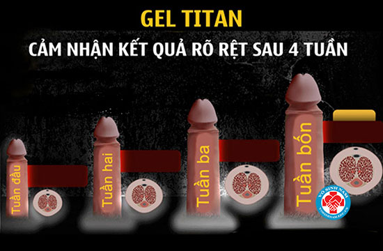 Sự thật về những tác dụng của Gel Titan là gì ? 